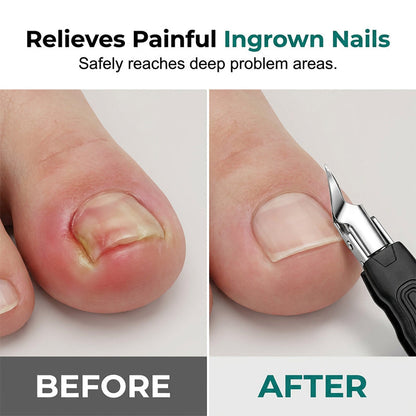 ✂️Conjunto profissional 3 em 1 para pedicure – Ferramenta de precisão para unhas em aço inoxidável ✨